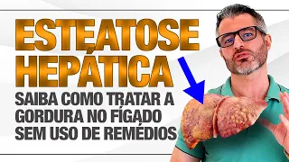 ESTEATOSE HEPÁTICA: como tratar a gordura no fígado ⚠