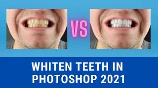 How to Whiten Teeth Professionally - Photoshop CC 2021