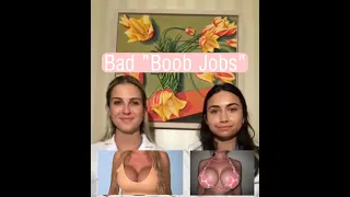 Bad Breast Augs with Sam & Meg