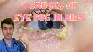 Doctor explains 4 causes of eye pus, discharge or sticky eyes in kids | Doctor O'Donovan