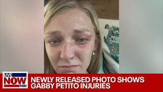 Gabby Petito update: Newly released photo shows injuries from Utah domestic call | LiveNOW from FOX