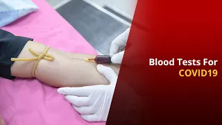 COVID19: Types Of Blood Tests You Can Go For | News Mo