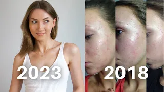 How I Transformed My Skin and Look Younger (what I've learned)