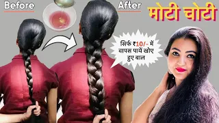 सबसे *ताकतवर Hair Growth* Challenge, बालों को महीने भर में मोटा लम्बा घना कर देगा, Zero Hair Fall❤️