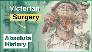 The Crude Science Behind Victorian Medicine | How The Victorians Built Britain | Absolute History