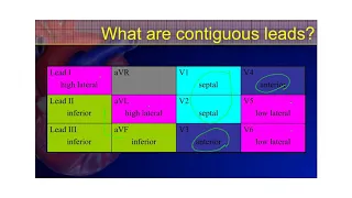 The 12-Lead ECG Course: STE-Mimics Part 1