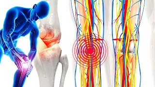 Body Detoxification + Heals The Knee Joint - Frequencies For Dissolving Toxins, Emotional & Physical