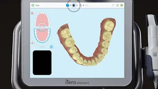 iTero® Scanner Tutorial: Adding a New Case Type