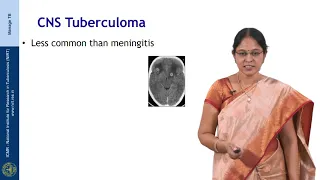 Clinical manifestations of TB-Session 01