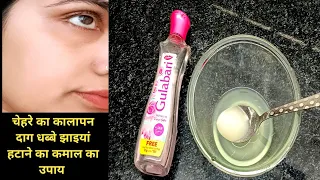 सिर्फ 3 दिन में चेहरे की गहरी झाइयां काले निशान दाग धब्बे पिंपल्स के निशान खत्म कर देगा नुस्खा