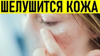 У МЕНЯ ШЕЛУШИТСЯ КОЖА | Почему шелушится кожа на лице и что с этим делать