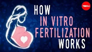 How in vitro fertilization (IVF) works - Nassim Assefi and Brian A. Levine