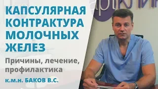 Капсулярная контрактура после маммопластики: профилактика и лечение