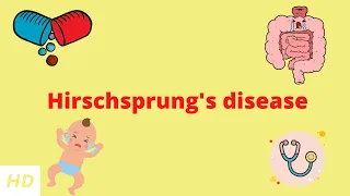 Hirschsprung's Disease, Causes, Signs and Symptoms, Diagnosis and Treatment.