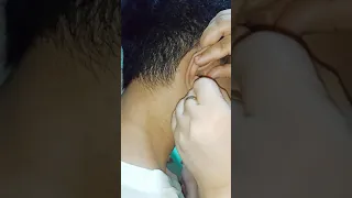 HOW TO REMOVE COTTON FROM EAR