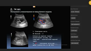 УЗД кистозных дисплазий почек у детей на клинических примерах