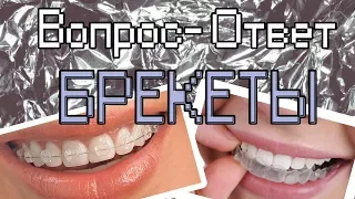 БРЕКЕТЫ | ВОПРОС-ОТВЕТ