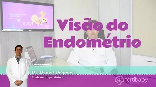 Qual é o momento ideal para transferência embrionaria? (visão do endométrio)