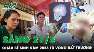 Tin Nóng: Công An Điều Tra Vụ Việc Cháu Bé Sinh Năm 2023 Tử Vong Do Nứt Sọ Não Bất Thường | SKĐS