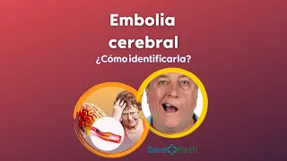 ¿QUÉ ES UNA EMBOLIA CEREBRAL?