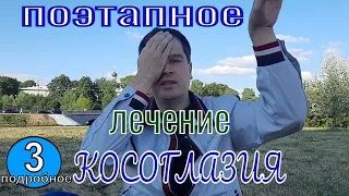 Подробно.  Лечение Косоглазия. Поэтапное видео.