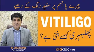Vitiligo Symptoms & Treatment - Phulbehri Ka Ilaj In Urdu/Hindi - Skin Pe White Spots Kyu Hote Hain