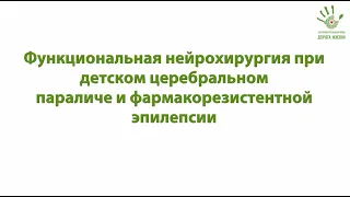 Видео-лекция "Функциональная нейрохирургия при ДЦП и фармакорезистентной эпилепсии"