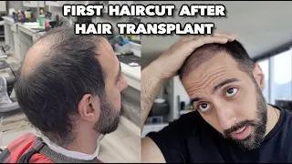 FIRST HAIR CUT AFTER A HAIR TRANSPLANT