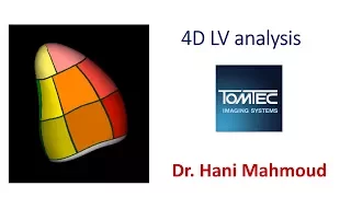 4D LV analysis using TomTec software