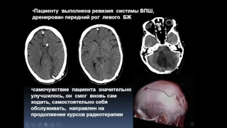 Клиническое наблюдение. Случай тяжелого лечения болезни Гиппеля-Линдау у молодого пациента