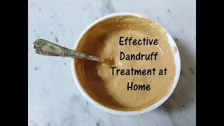 Dandruff Treatment at Home | Best Home Remedy to clear Dandruff