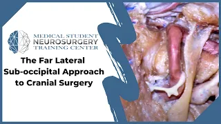 The Far Lateral Sub-occipital Approach to Cranial Surgery