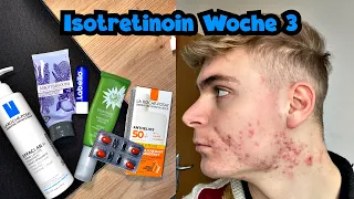 Aktuelle Hautpflege und jetzt Sport machen? / Isotretinoin Tagebuch Woche 3