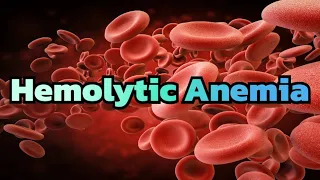 Hemolytic Anemia (updated 2023) - CRASH! Medical Review Series