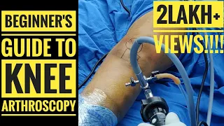 Beginner's Guide to Knee Arthroscopy