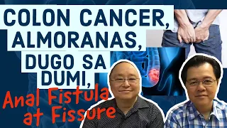 Colon Cancer, Almoranas, Dugo sa Dumi, Anal Fistula at Fissure - Payo ni Doc Willie Ong #188