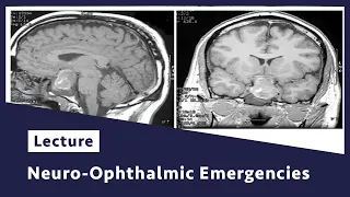 Neuro-ophthalmic Emergencies