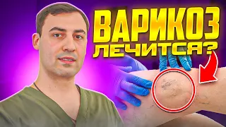 Эффективные методы лечения и профилактики варикозного расширения вен