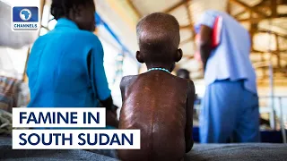 South Sudan Food Crisis Now Critical, Eliminating NTDs + More | Network Africa