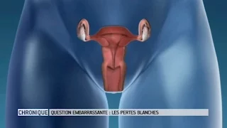 Pertes vaginales, pertes blanches : faut-il s'inquiéter ? - Le Magazine de la santé