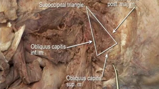 1.1 Step 5:  Suboccipital triangle