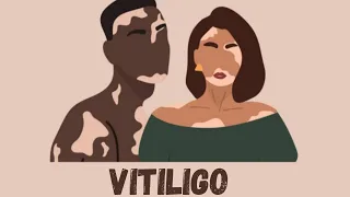 Vitiligo Types, Causes, symptoms & Treatments                      #vitiligo #autoimmune_disease