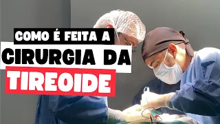 Como é feita a cirurgia de tireoide: Dr. Jônatas Catunda explica passo a passo