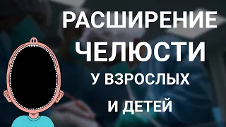 Расширение челюсти у взрослых и у детей