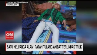 Satu Keluarga Alami Patah Tulang Akibat Terlindas Truk