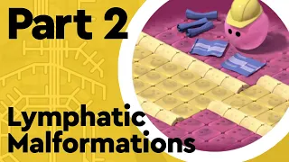 What are Lymphatic Malformations? (Lymphatic System Part 2)