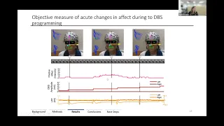 Obsessive Compulsive Disorder (OCD) and deep brain stimulation