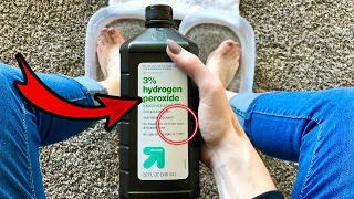 13 Surprising Uses of Hydrogen Peroxide! 💥 (WATCH WHAT HAPPENS)