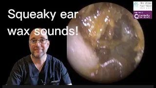 Squeaky ear wax sounds - Episode 66 #earwaxremoval