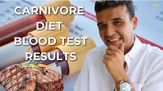 Carnivore Diet Blood Work Results! Is My Cholesterol SKY HIGH?!?
